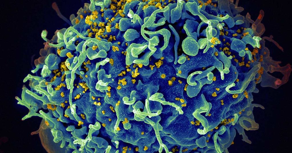 HIV, das AIDS Virus (gelb) infiziert eine menschliche Zelle. Mit einem Geschlechtskrankheiten Test kann man sich auf HIV testen.