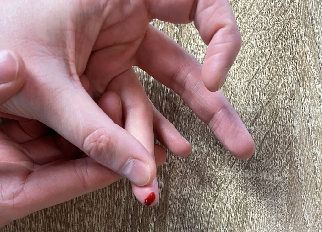 Foto einer Hand, bei der mit einer Lanzette in einen Finger gestochen wurde, um Blut für den For You eHealth Immunsystem-Test abzunehmen. 